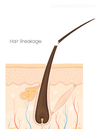 Hair Breakage Diagram